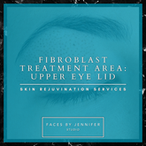 Fibroblast Treatment Area: Upper Eye Lid