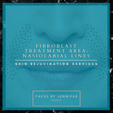 Fibroblast Treatment Area: Nasiolabial Lines