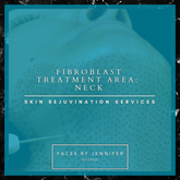 Fibroblast Treatment Area: Neck