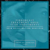 Fibroblast Treatment Area: Scars Treatment