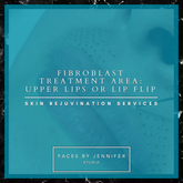 Fibroblast Treatment Area: Upper Lips or Lip Flip