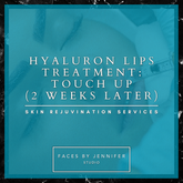 Hyaluron Lips Treatment Touch Up (2 Weeks Later)