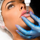 Hyaluron Lips Treatment: (1 Vile)