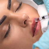 Hyaluron Lips Treatment Touch Up (2 Weeks Later)