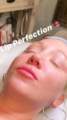 Add On to any Facial-Meso Lip Plump Treatment
