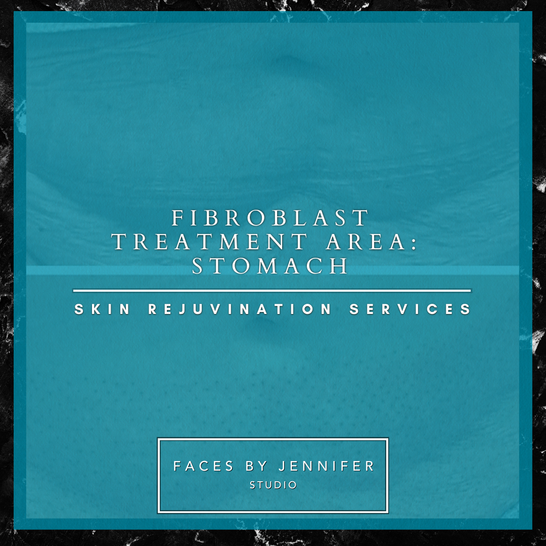 Fibroblast Treatment Area: Stomach