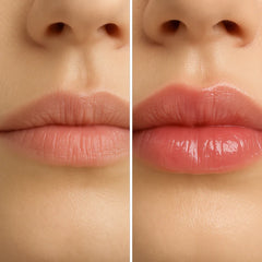 Add On to any Facial-Meso Lip Plump Treatment